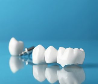 A Complete Guide to Dental Crown Types and Materials